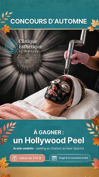 Concours Gagnez un peeling au charbon au laser Spectra!