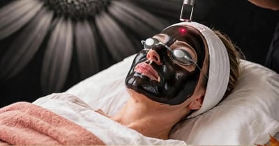 Concours Gagnez un peeling au charbon au laser Spectra!